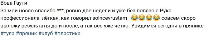 Владимир Гаути похвастался новым носом