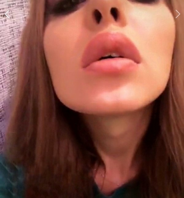Юлия Ефременкова в восторге от своих новых губ