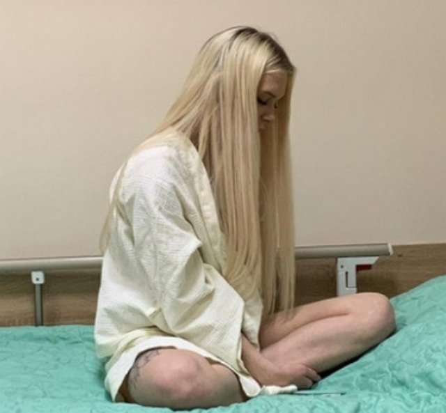 Шевцова передумала увеличивать грудь за несколько минут до операции