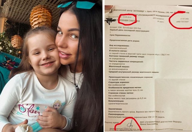 Александра Шева: Для меня беременность — это святое Александра Шева: Для меня беременность — это святое
