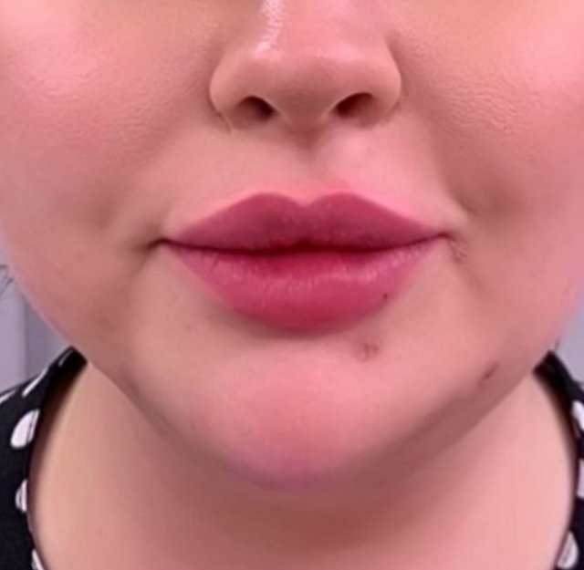 Из блога Редакции: Александра Черно увеличила губы