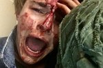 Никита Турчин: Мне нанесли множественные травмы