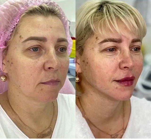 Блог редакции: Мама Савкиной и Рапунцель побывала у косметолога