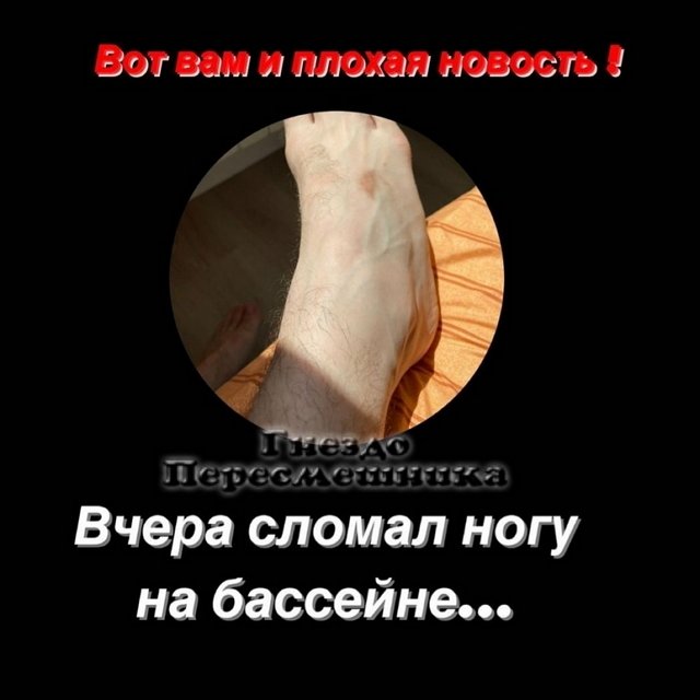Иосиф Оганесян: На бассейне сломал ногу