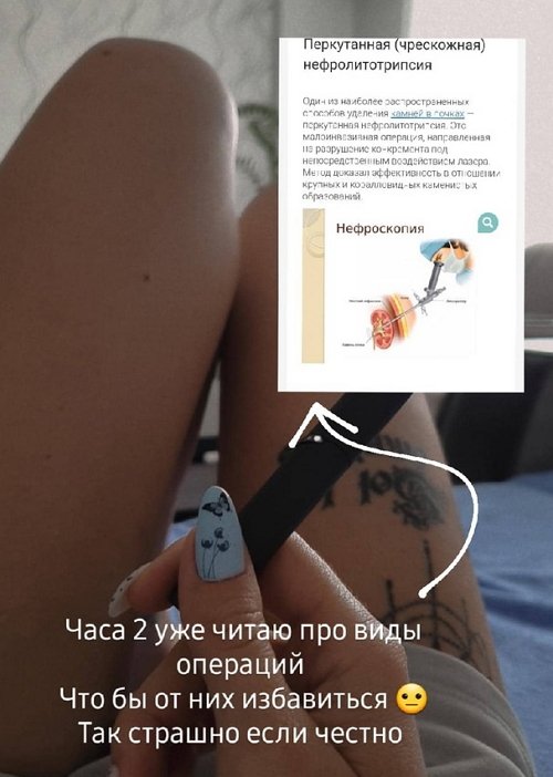 Ольга Ветер: Читаю про виды операций