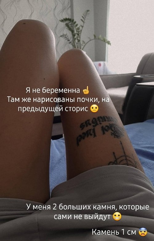 Ольга Ветер: Читаю про виды операций
