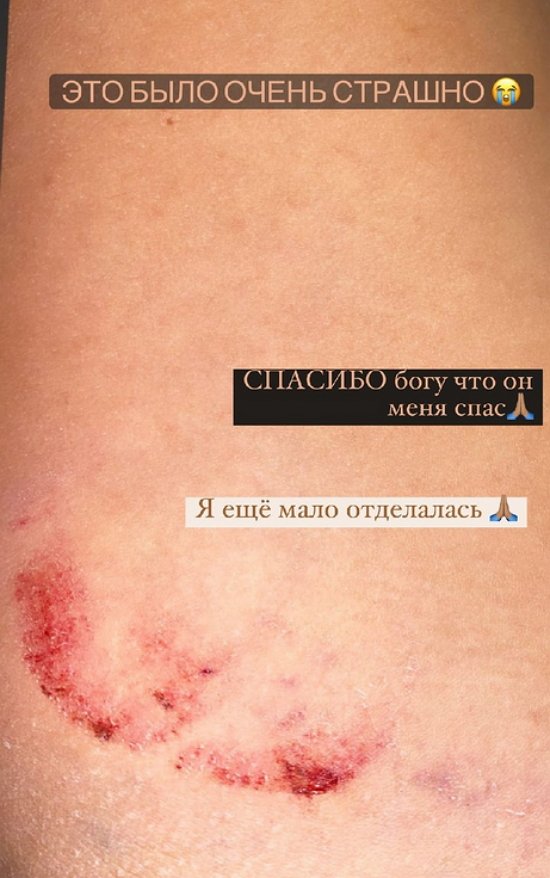 Кристина Бухынбалтэ: Я думала, что не выживу там!