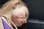 Алёна Ашмарина: Что лучше для восстановления?