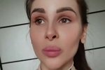 Анастасия Голд: Уже прошел год, а нос так и не зажил