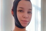 Юлия Салибекова: Очень быстро все заживет и я опять буду порхать!