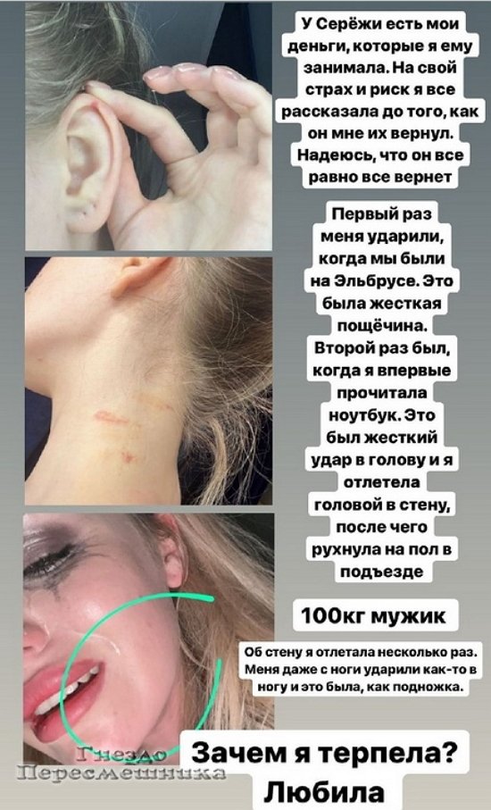 Милена Безбородова: Он ударил в голову, я даже улетела в стену