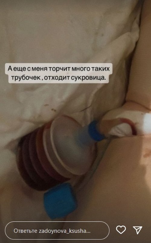Ксения Задойнова: Дышу через боль