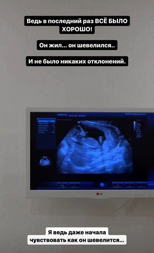 Елизавета Полыгалова: Это я виновата?