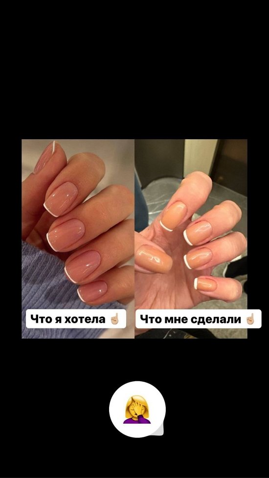 Елена Хромина: Я до сих пор восстанавливаю ногти!