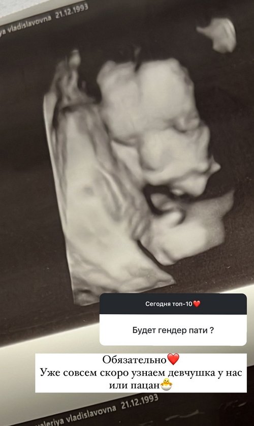Валерия Ткачёва: Я очень нехороший враг