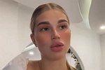 Анастасия Ромашова: Мой вес связан с моим заболеванием
