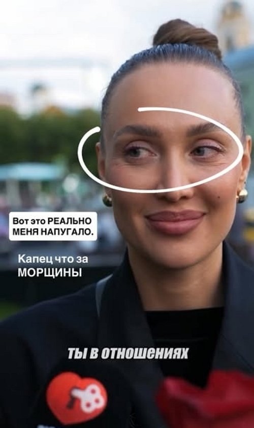 Лиза Полыгалова: Я сразу же понеслась к косметологу