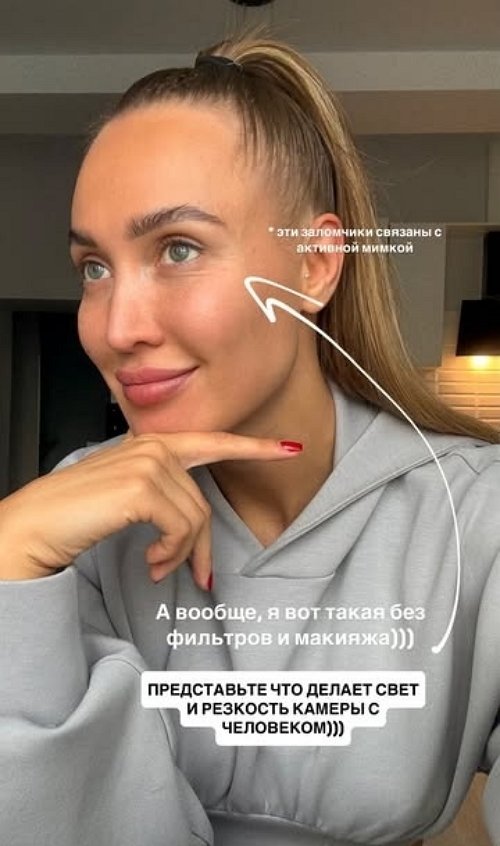 Лиза Полыгалова: Я сразу же понеслась к косметологу