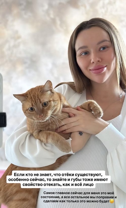 Татьяна Репина: Ох уж эти мои губы