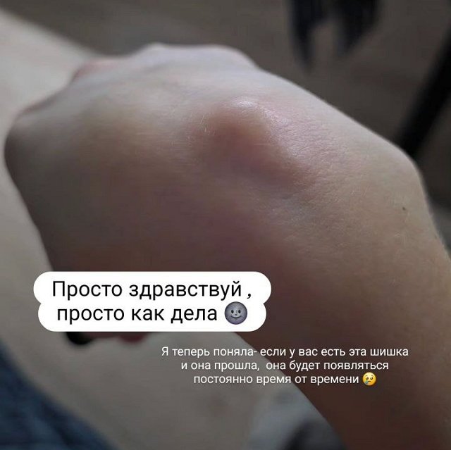 Ольга Ветер: Она снова появилась