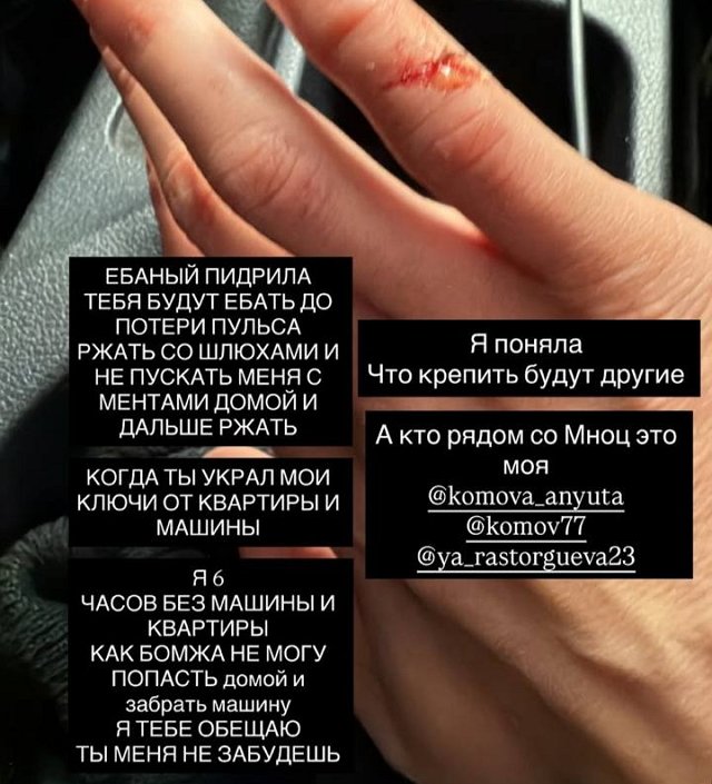 Анну Брянскую избил возлюбленный