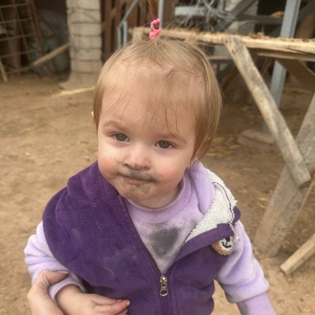 Анна Евстропова занялась лечением аллергии у дочери