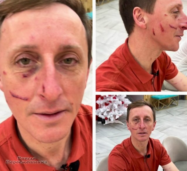 Дмитрий Лысковец: Ноги в руки и чеши на вокзал