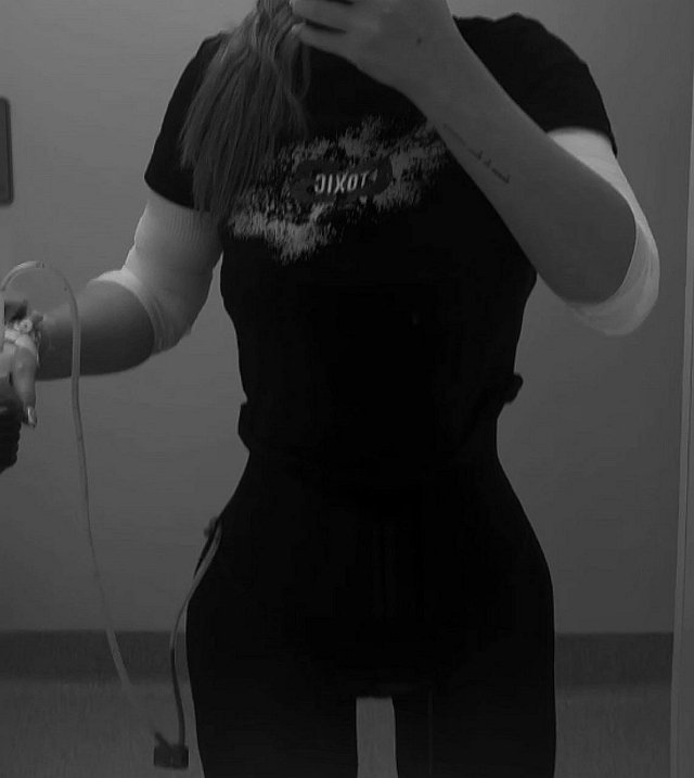 Катя Горина показала результаты липомоделирования