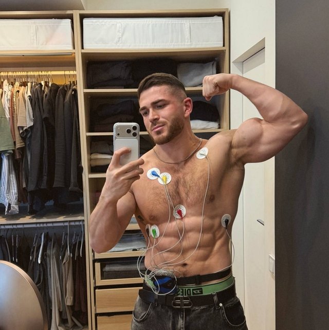 Роман Капаклы: Скоро буду бегать как конь