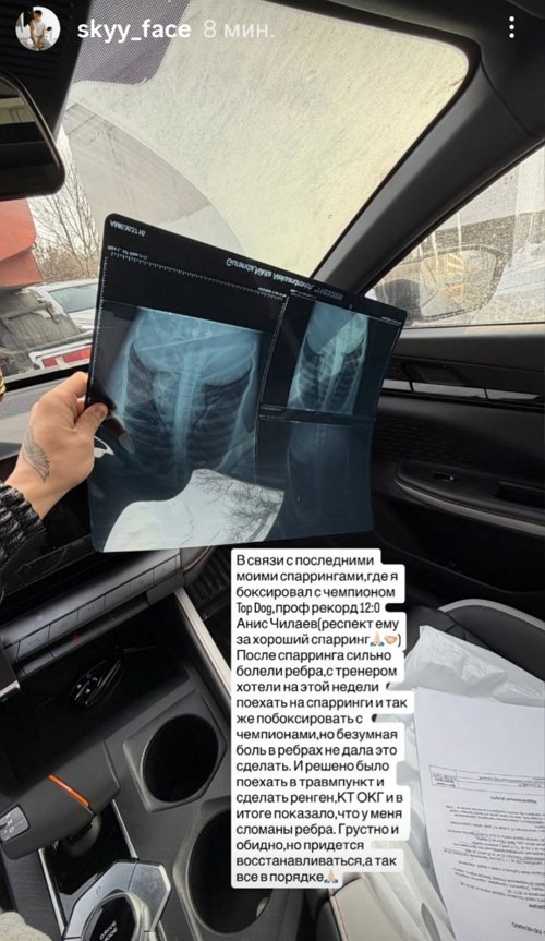 Никита Гуранда: У меня сломаны рёбра