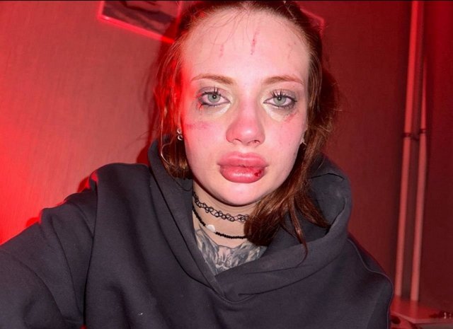 Ксения Карпова: Он поступил ужасно по отношению ко мне Ксения Карпова: Он поступил ужасно по отношению ко мне