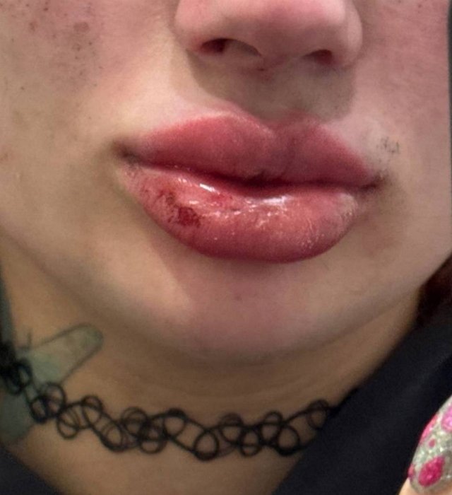 Ксения Карпова: Он поступил ужасно по отношению ко мне Ксения Карпова: Он поступил ужасно по отношению ко мне