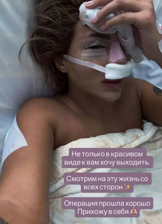 Виктория Дилье «подсела» на пластические операции Виктория Дилье «подсела» на пластические операции