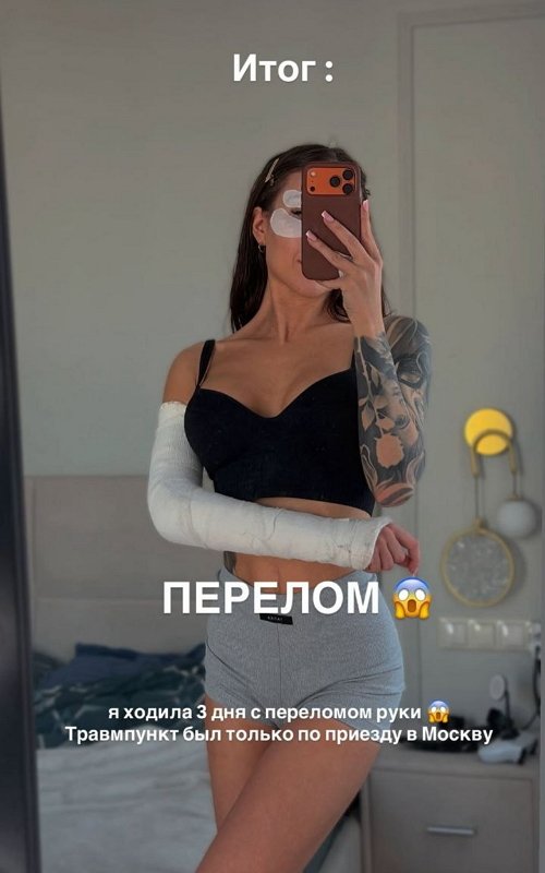 Отдых на Байкале закончился для Алёны Савкиной в травмпункте