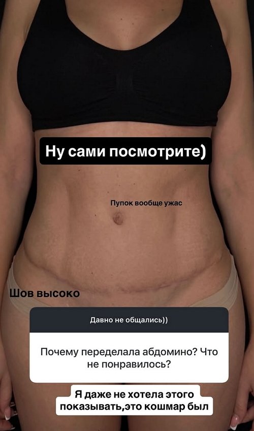 Ирина Пинчук: Лучше не позорьтесь