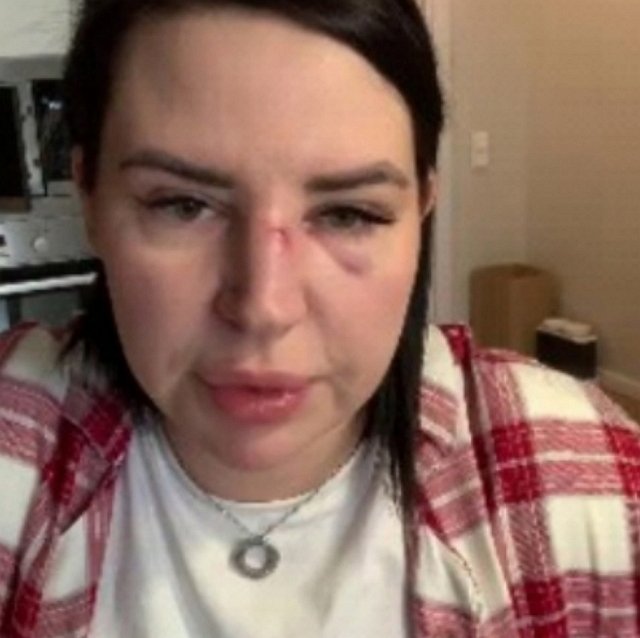 Хейтеры Александры Черно злорадствуют над её бедой