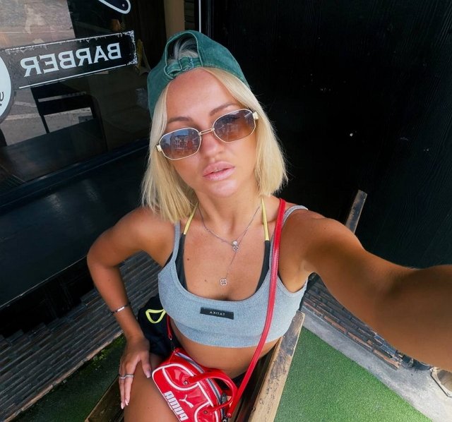 У Рахимовой начались проблемы с отёками и лишним весом