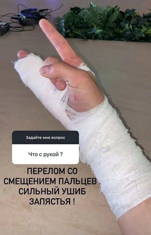 Роман Кузин: Перелом со смещением