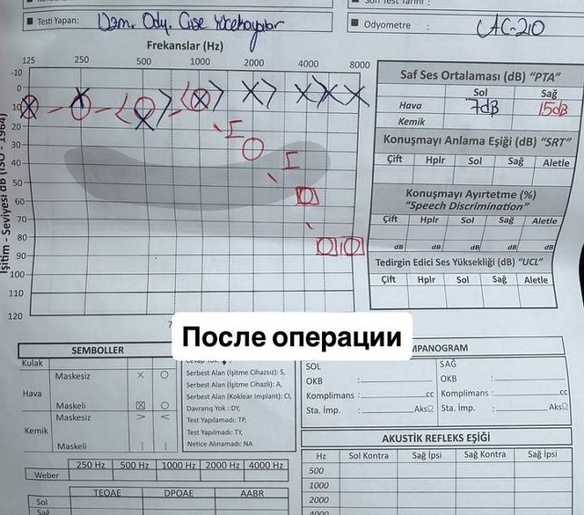 Рита Марсо: Я сразу побежала сдавать тест