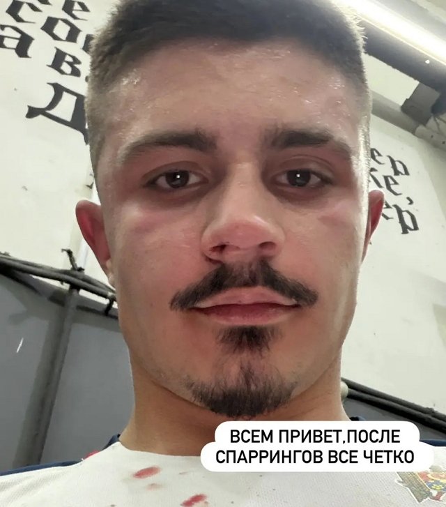 Никите Гуранда «пустили кровь» во время спарринга Никите Гуранда «пустили кровь» во время спарринга