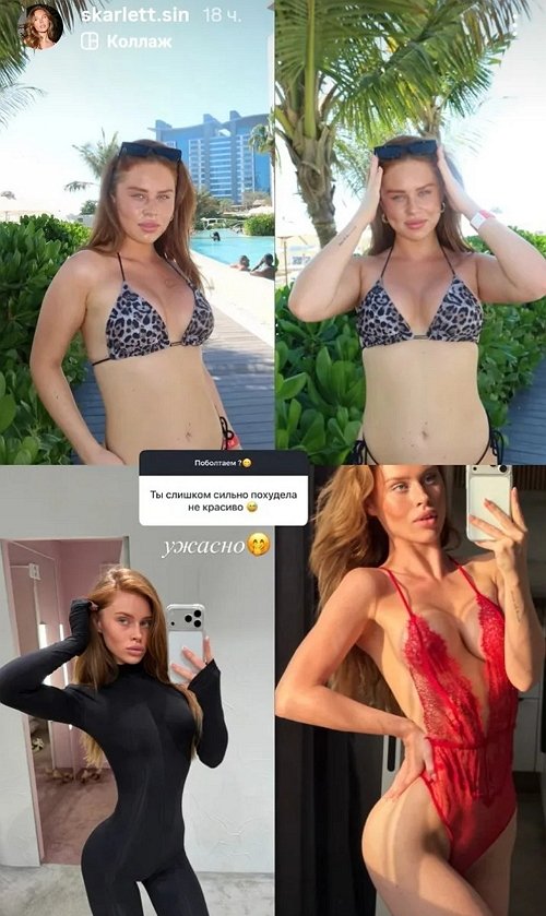 Катя Горина: Что я сделала с лицом?