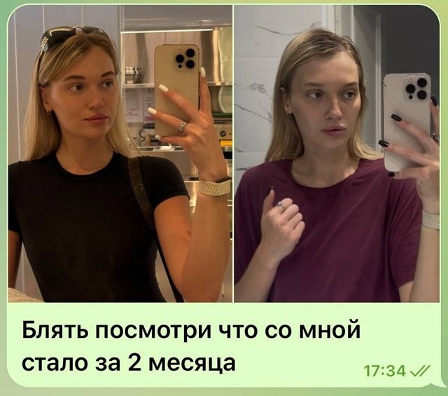 Ивана Михайличенко: Не надо меня жалеть Ивана Михайличенко: Не надо меня жалеть