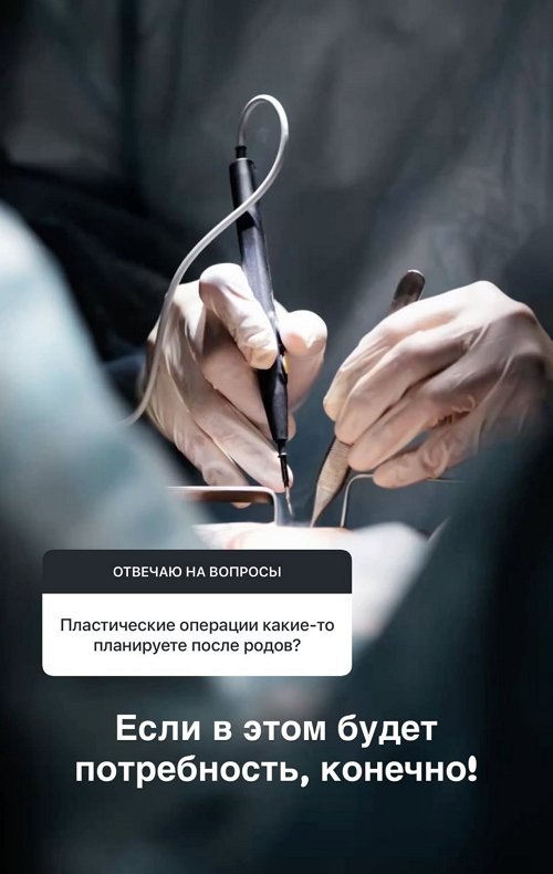 Настя Ромашова: Мы заключили нестандартный контракт